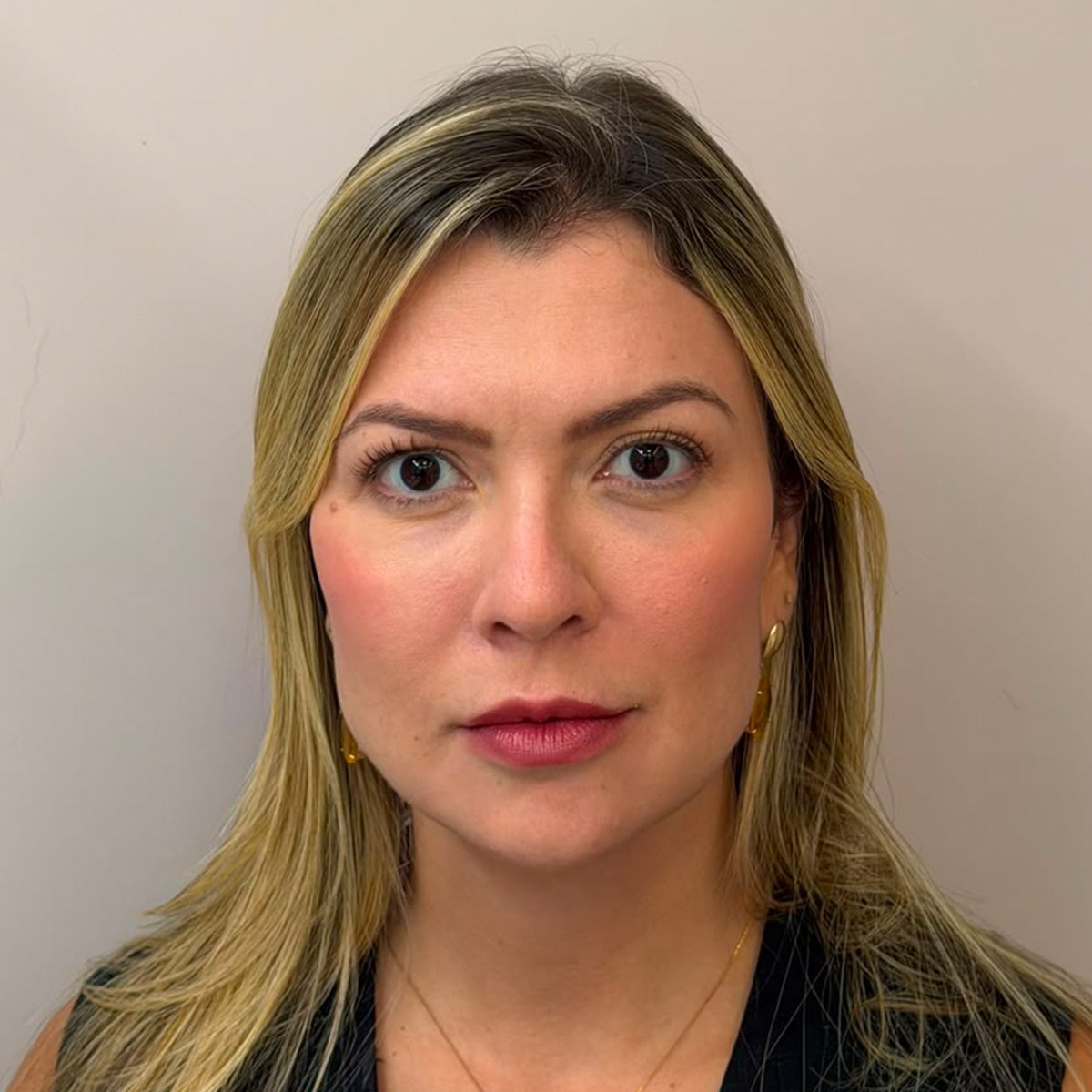 Harmonização Facial